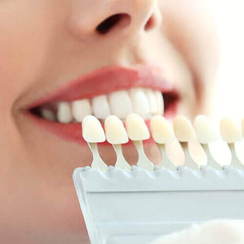 Cosmetic Dentistry in Rochdale